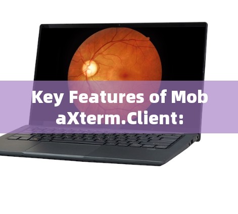 Key Features of MobaXterm.Client: